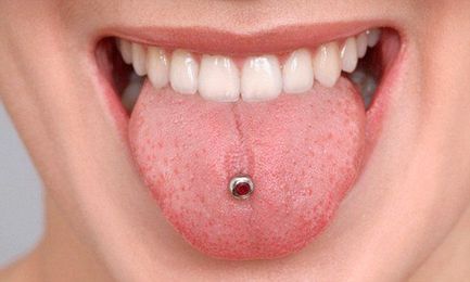 How tongue piercings can ruin your smile...