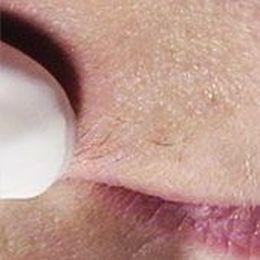 Do You Need Electrolysis?