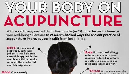 10 Pretty Fantastic Reasons To Try Acupuncture