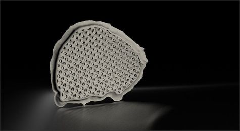 Autodesk releases cutting edge software for medical 3D printing