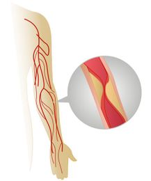 Is Your Loved One Being Adequately Hydrated in the Nursing Home?