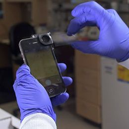 Massachusetts General Hospital tech uses smartphone camera to diagnose cancer