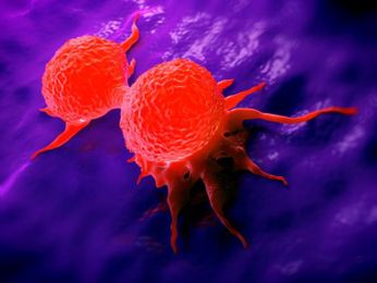 Nonfamilial breast cancer risk could be predicted by genetic alterations