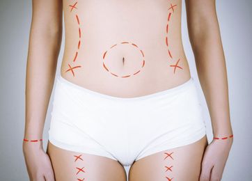 Botched: When plastic surgery goes horribly wrong — and how you can prevent it
