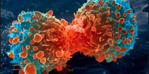 Halting firefighter cancer starts with clean PPE