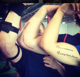 Preventing Baseball Injuries: Actions Speak Louder Than Words