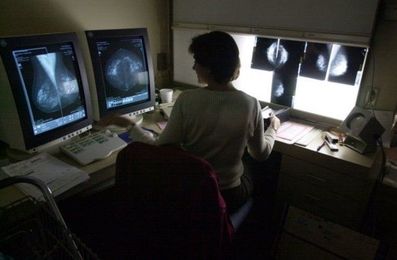 The benefits of beginning annual mammogram screenings at age 40
