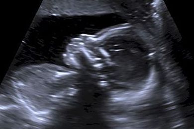 A head-to-toe tour of your baby’s ultrasound