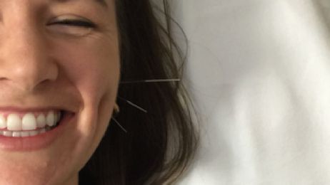 Acupuncture: who it can help. Cancer Treatment Centers of America