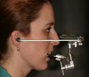 9 Steps to a Facebow Transfer