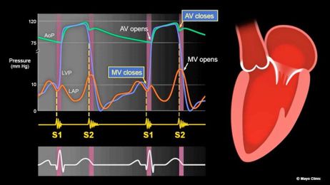 Mayo Clinic Minute: What Heart Sounds Tell Us