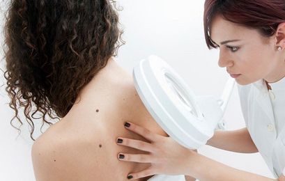 Is It Just A Mole—Or Something Worse?