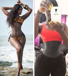 Model Says Her Kidney Disease Was Caused By Waist Trainer