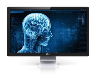 Three Factors to consider when implementing a Vendor Neutral Archive (VNA)