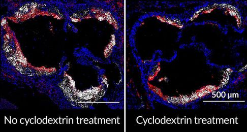 A sugar can melt away cholesterol