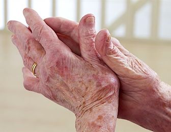 Management of Arch Pain