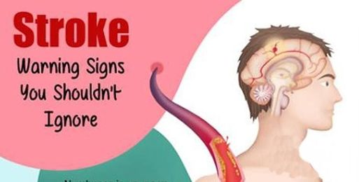 Stroke Warning Signs You Shouldn’t Ignore !