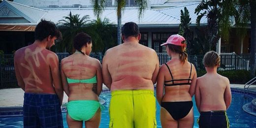 These People Used Spray-On Sunscreen Incorrectly And Their Tan Lines Are Unbelievably Insane