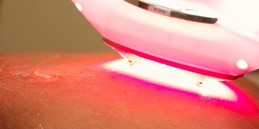 9 Myths About Laser Hair Removal And Waxing