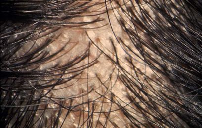 8 Ways To Tell If Your Hair Is Thinning Before It's Too Late