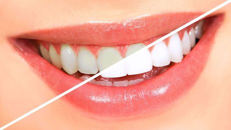 What a cosmetic dentist can do for your smile