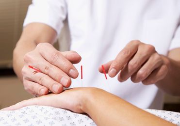 12 Questions About Insurance and Alternative Medicine