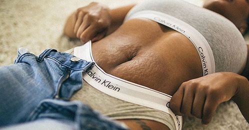 Why One Mom Is Showing Off Her Stretch Marks in These Gorgeous Photos