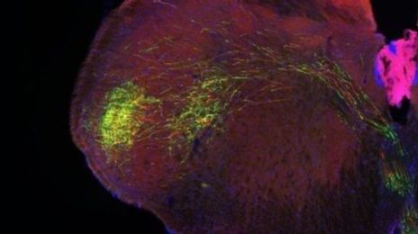 Brain-Data Gold Mine Could Reveal How Neurons Compute