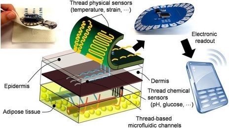 Researchers develop connected stitches that transmit patient health data