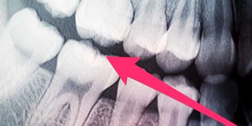 A dentist told us the surprising effect sleep has on your teeth