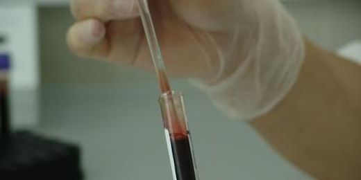 3 Things You Should Know Before Your Next Screening Test