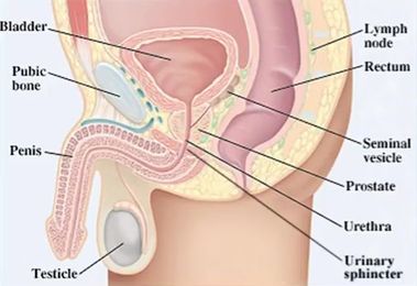 Incontinence after Prostate Cancer Treatments: What You Need to Know