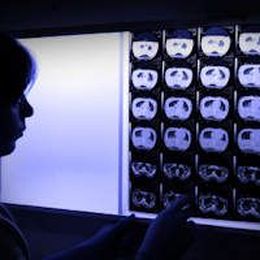 Patients want radiologists reading their exams