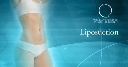 Questions to ask your liposuction surgeon