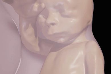 This 3-D scan lets parents, doctors really see babies in the womb