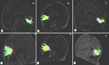 Remarkable images show how learning an instrument boosts brain power