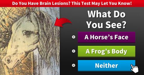 Do You Have Brain Lesions? This Test May Be Able to Detect Them!