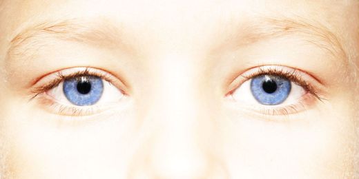 If You Have Blue Eyes, They're Actually Brown 