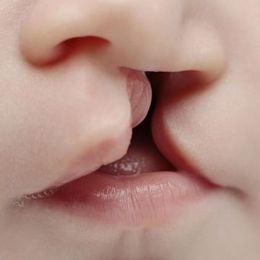 Facial Plastic Surgery to Complement Your Features