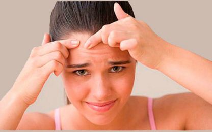 5 Things You Should Know About the Link Between Dairy and Acne