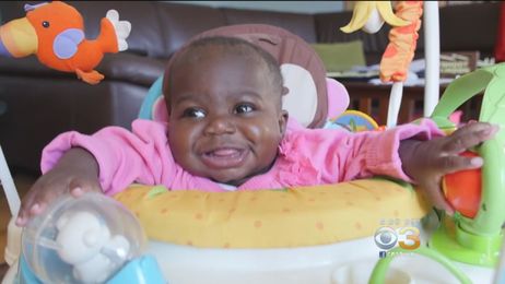 Baby Girl Born With 4 Legs Gets New Lease On Life