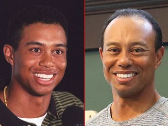 Tiger Woods: Good Genes Or Good Docs?