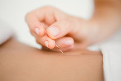 Could Acupuncture Be Right for You?