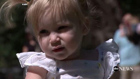 Toddler w/ Childhood Alzheimer's symptoms gets Experimental Treatment