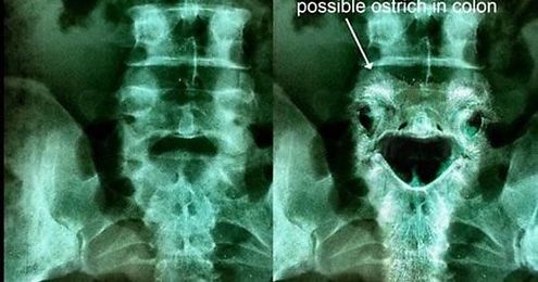 Preparing for my radiology boards when I saw this.