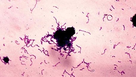 Milk from Indonesian pony breed effectively inhibited tooth decay bug