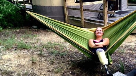 I Survived Flesh-Eating Bacteria—and It Changed My Life Forever