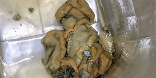 This "Octopus-Looking Mold" Was Found in a Woman's Fancy Coconut Water
