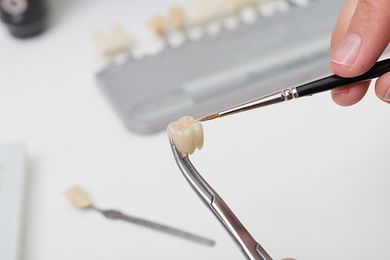 Should You Get Dental Crowns?