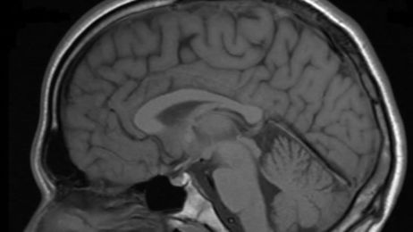 Current ‘Moral Enhancement’ Technologies Are Neither Feasible Nor Wise